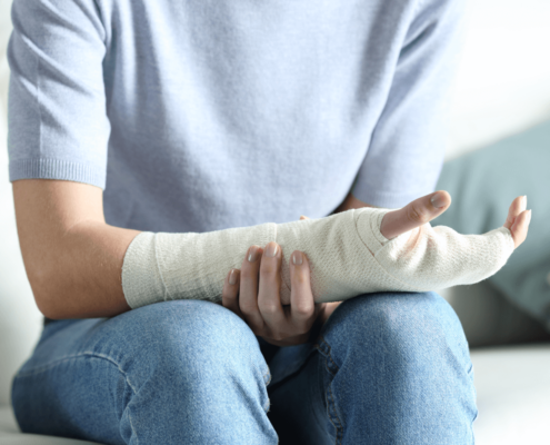 Foto de una persona con la mano escayolada, que ilustra el artículo "El despido disciplinario encubierto durante las fases finales de IT" de Ponter Abogados y Asesores